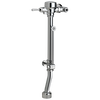 MFV with BP Washer and 26" High WT OS Tube